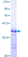 12.5% SDS-PAGE Stained with Coomassie Blue.